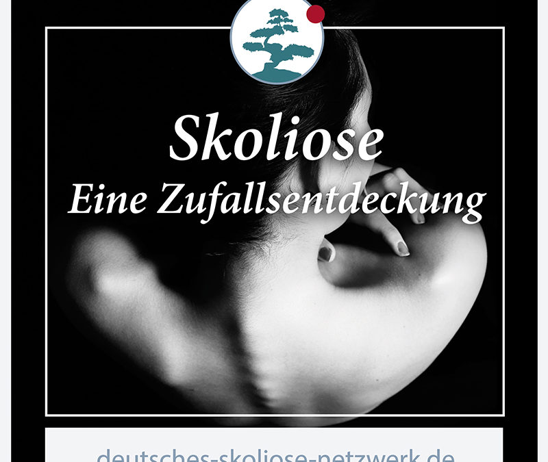 Skoliose -Eine Zufallsentdeckung?