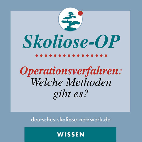 Operationsverfahren: Welche Methoden gibt es?