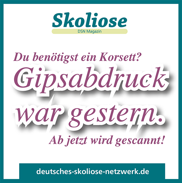 Korsett: Gipsabdruck war gestern!