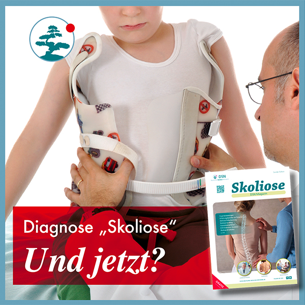 Diagnose Skoliose