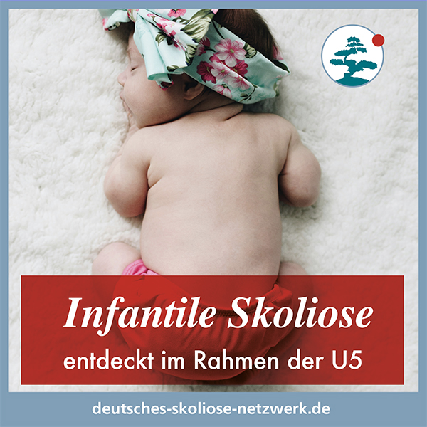 Infantile Skoliose