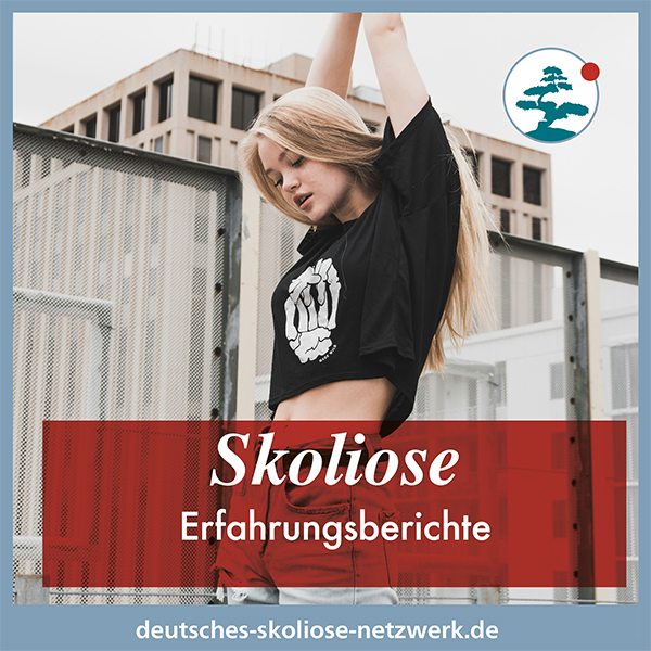 Skoliose – Online-Erfahrungsberichte