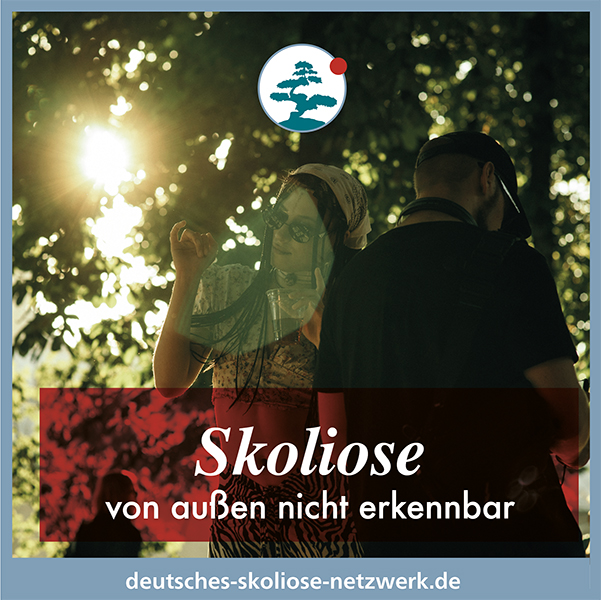 Skoliose – von außen nicht erkenntbar