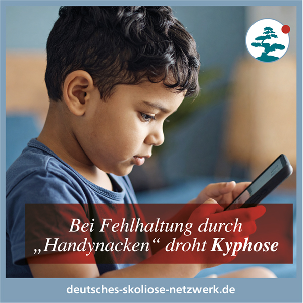 Bei Fehlhaltung durch „Handynacken“ droht Kyphose