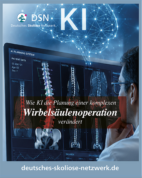Wie KI die Planung einer komplexen Wirbelsäulenoperation verändert